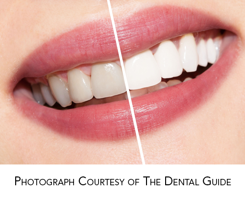 Make Your Teeth Whitening Gel Work&nbsp;Better!